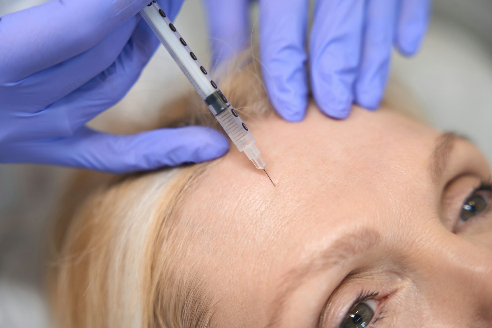 Close up of adult woman getting antiwrinkle forehead injection